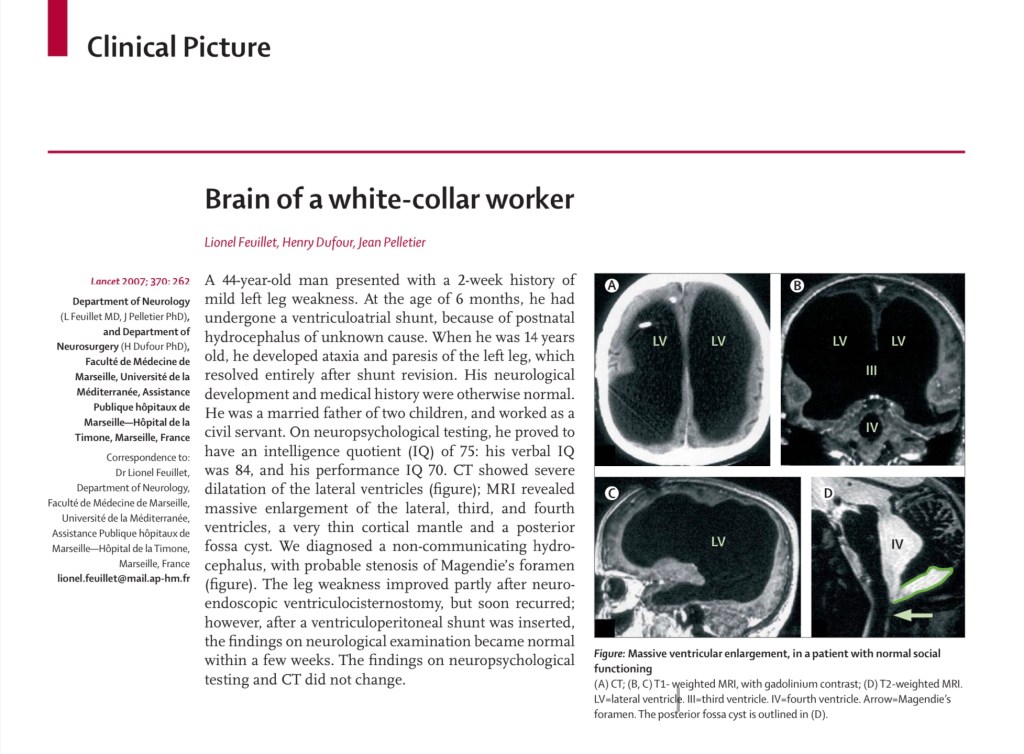 Brain volume and consciousness